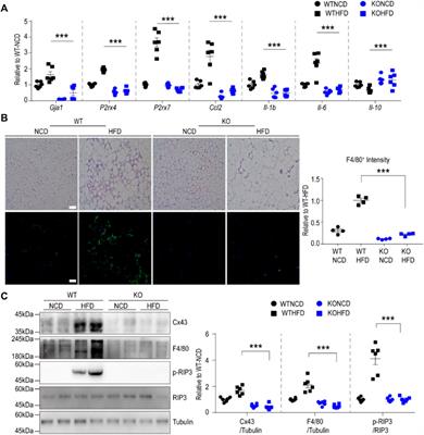 Macrophage-Specific Connexin 43 Knockout Protects Mice from Obesity-Induced Inflammation and Metabolic Dysfunction